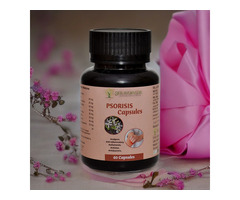 Best Ayurvedic Medicine for Psoriasis