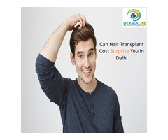 Can Hair Transplant Cost Surprise You in Delhi?