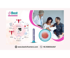 Trusted Fertility Centers in Hyderabad: Bestivfcenters