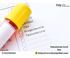 Affordable Testosterone Test Price in Delhi Today