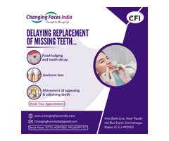 Worried About Missing Teeth? Delay Can Be Risky!