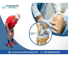 Revision Knee Replacement Treatment in Bangalore: Dr.Nataraj H M