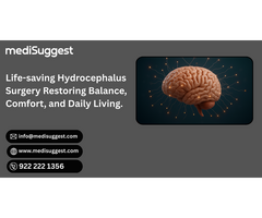 Hydrocephalus Surgery Near Bhayander