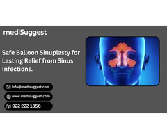 Balloon Sinuplasty Surgery