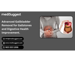 Understanding Cholecystectomy