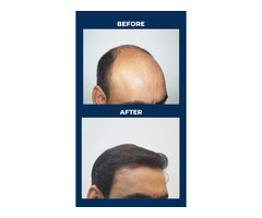 Best Cosmetic & Plastic Surgery Clinic in Hyderabad – Personiks