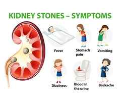 How a Kidney Stone Specialist Diagnoses and Treats Your Pain