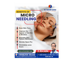 Microneedling Treatment for Skin Rejuvenation in Rewa